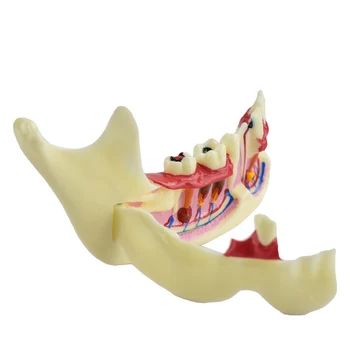 שיניים טיפול שורש מודל האנטומיה רקמה אנטומיים מודל האנטומיה של החניכיים ללמוד שיניים חומרים