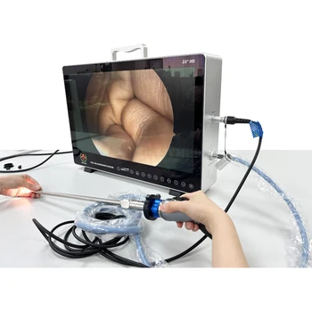 סיי-PS050 נייד אנדוסקופי אדם ורפואה וטרינרית Full Hd 1080p משולבים אף אוזן גרון/לפרוסקופיה/אורולוגיה רפואי אנדוסקופיה המצלמה